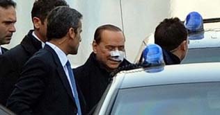 Italy's Berlusconi pardons attacker: reports